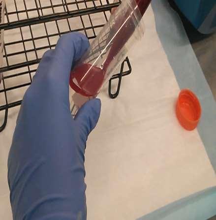 The Overlay Process Allow the tip of the serological pipette to touch the interface or place slightly above