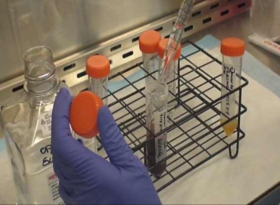 Dilution The blood to WDR dilution allows for the cells to be dispersed in solution, suitable for the density