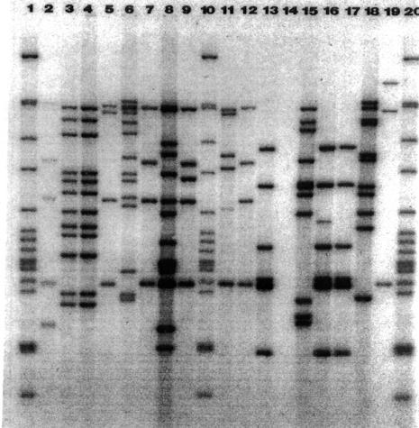 DNA fingerprinting of M.