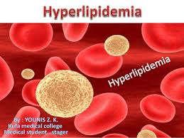 Management of hyperlipidemia in