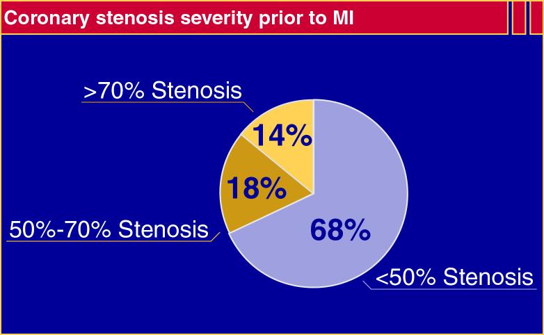Most Myocardial Infarctions Are Caused by Low-Grade Stenoses Pooled data from 4 studies: Ambrose et al, 1988; Little