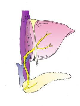 Anatomical Change of the Biliary