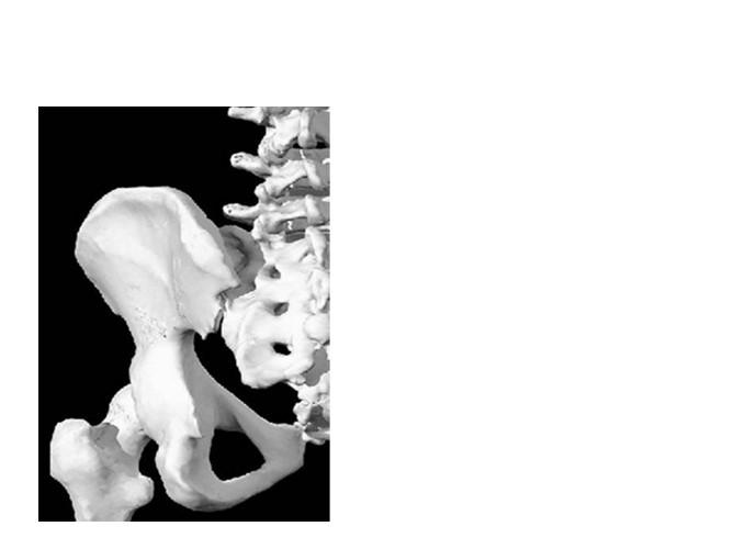 tuberosity LOD: Anterior and inferior Posterior-Inferior (PI) Ilium PI Ilium Correction 3 1 2 1. Spine of the Ischium LOD: Post-Sup-Lat 2.