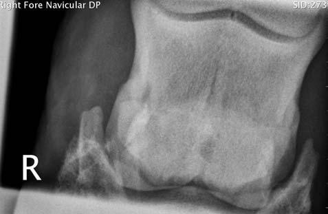 Heel Pain Aka Navicular Disease Navicular Bone is rarely the problem QuickTime and a Sorenson Video decompressor are needed to see this picture.