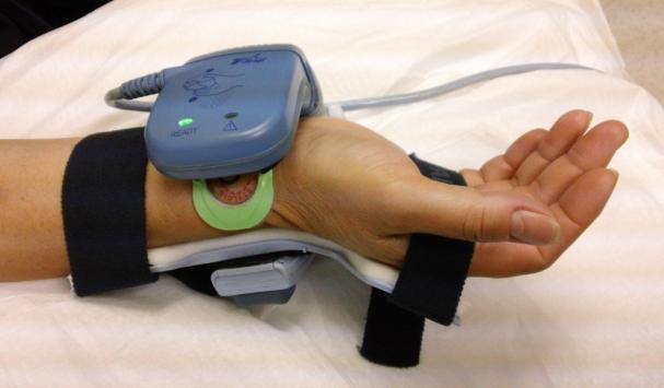 Non-invasive continuous blood pressure monitoring based on radial artery tonometry in the intensive care unit Background Based on radial artery