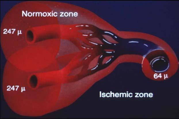 3ATA Oxygen Normoxic zone 64 u Ischemic zone 64