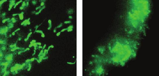 A, Representative images of murine lung endothelial cell (MLEC) mitochondrial morphology by Mitotracker green staining as a function of the indicated genotype and transfection with the indicated
