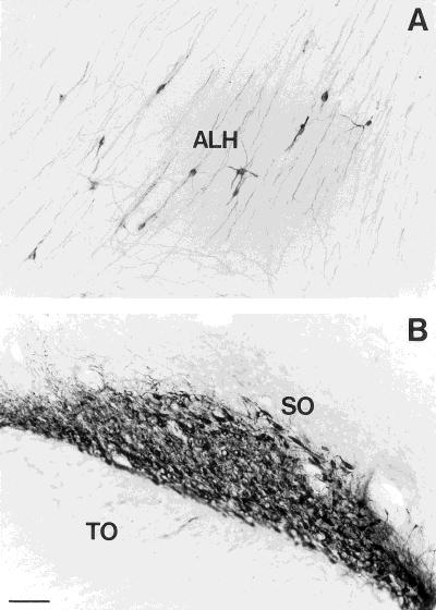 18 Z. WANG ET AL. Dense AVP-ir fibers from the SO projected towards the infundibulum forming neurohypophyseal tract, while some other fibers projected dorsally to the lateralis hypothalami.