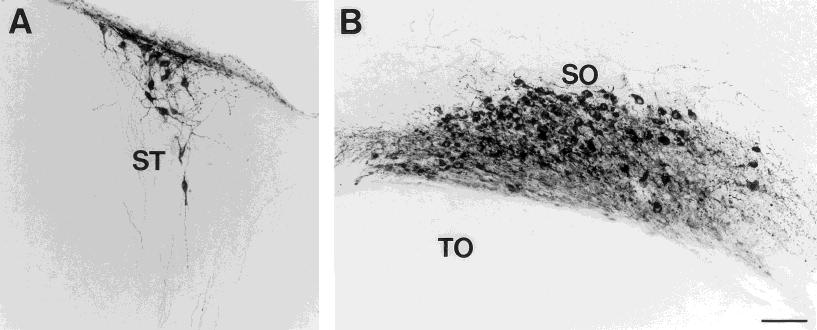 22 Z. WANG ET AL. Fig. 8. Photomicrographs displaying OT-ir cells in the stria terminalis (ST) (A) and supraopticus hypothalami (SO) (B) of a common marmoset. TO, tractus opticus. Scale bar 5 100 µm.