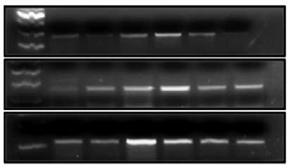 Lee JW, et l. 1 2 1 2 1 2 2 TNF- IL-1b mrna expression (%) 15 1 5 IL-6 IL-6 TNF- IL-1b Fig. 5. Chnges in inflmmtory cytokine gene expression in Long-Evns Tokushim Otsuk (LETO) nd Otsuk Long-Evns Tokushim Ftty (OLETF) rts.
