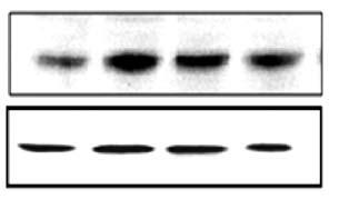 Chnges in levels of inflmmtory signling molecules in Long-Evns Tokushim Otsuk (LETO) nd Otsuk Long-Evns Tokushim Ftty (OLETF) rts.