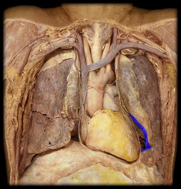 Anatomical View of the Thoracic Cavity Trachea Carotid Arties Brachiocephalic veins SVC Pulmonary