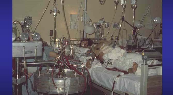 Objectives History of ECMO Physiology of ECMO UNM Current