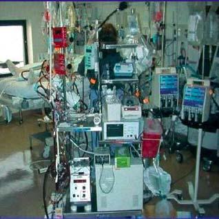 ECLS in 2005 It works But Complex Specialist Required System Failures Thrombogenic Vascular Access Can be