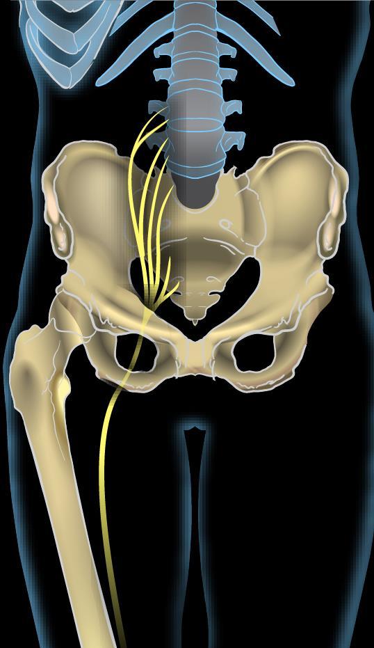 Exact data on the incidence and prevalence of sciatica are lacking.