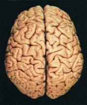 692 Unit Ten: Alterations in the Nervous System A B FIGURE 37-21 Alzheimer s disease. (A) Normal brain.