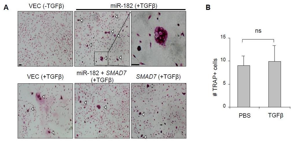 Supplementary Figure 9. SMAD7 mediates the role of mir-182 in osteoclastogenesis.