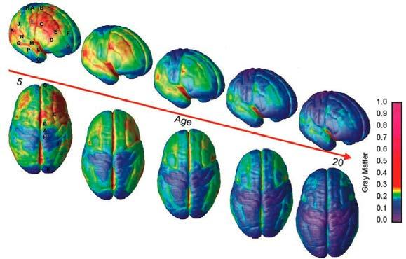 , Time-Lapse Imaging Tracks Brain Developing from ages 5 to 20,