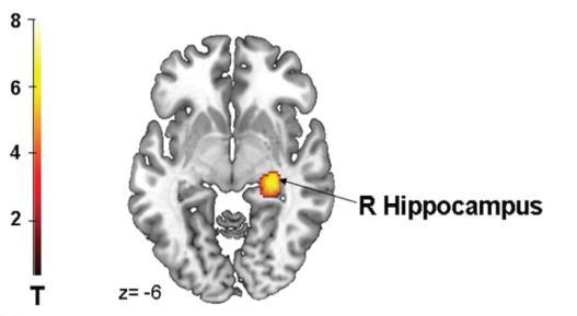 Hippocampal compensation hypothesis Could the lack