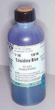 Tolonium Chloride binds to DNA A positive result means that