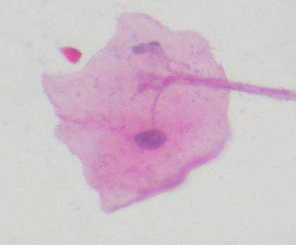 Oral Exfoliative Cytology for Diagnosis of Viral