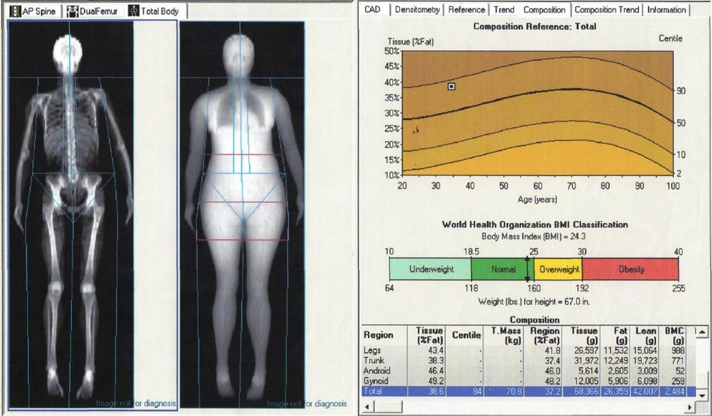 14 Pediatric DXA scan Image courtesy of GE Healthcare adolescents can be influenced by many factors including: disease, nutritional issues, medications, environmental elements, and lack of weight