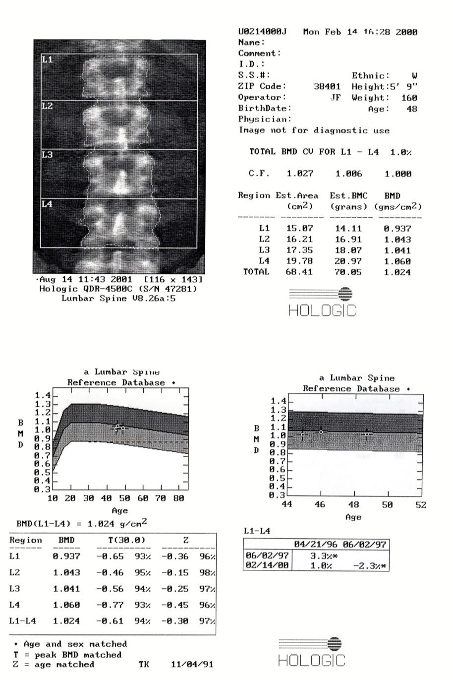 Contraindication for DXA body composition includes pregnancy, exceeding the scanner weight limits, and recent administration of contrast material.