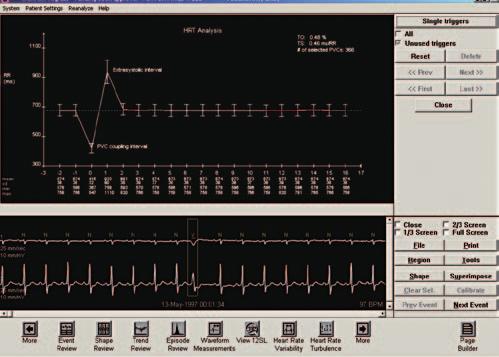 The power to predict Diagnostic algorithms support better outcomes Since the introduction of the industry-leading Marquette 12SL ECG analysis program, GE Healthcare has continued to develop the