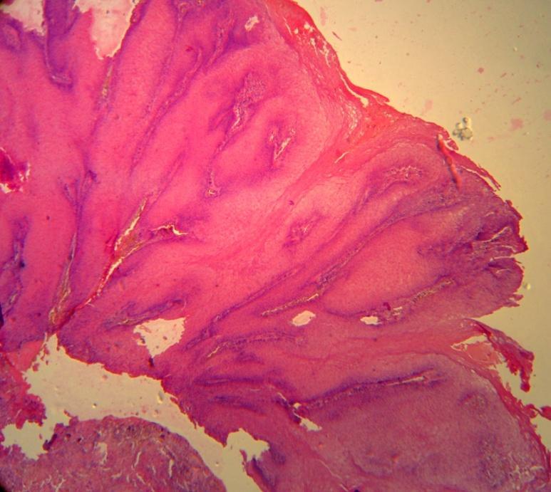 showing histological picture of