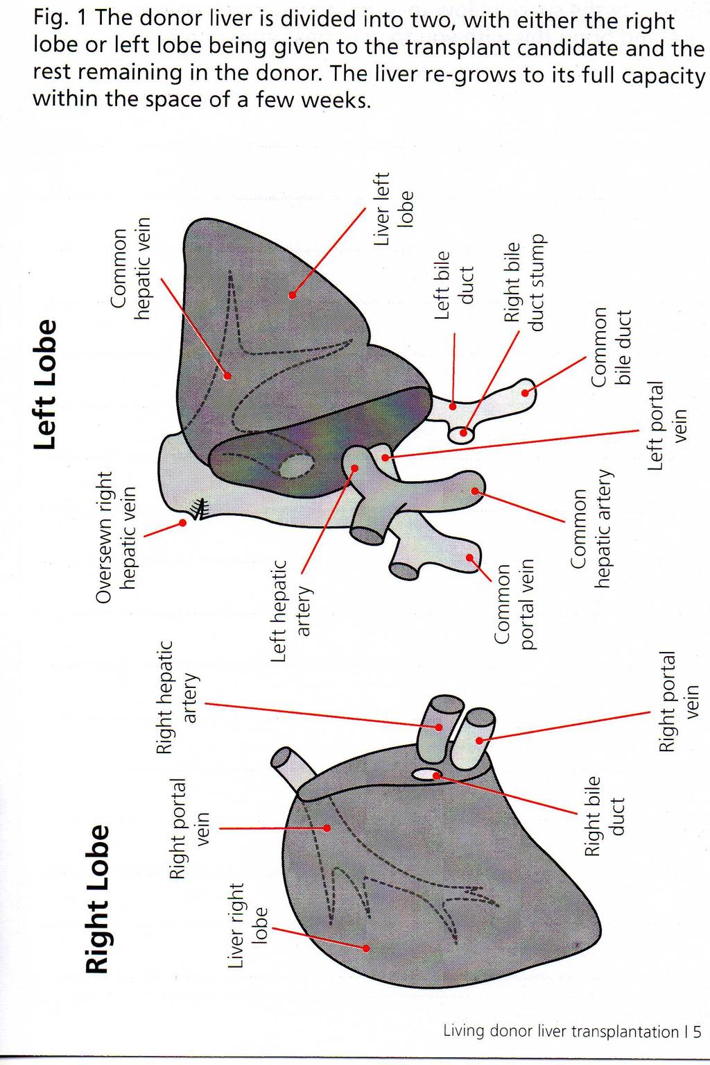 Fig. 1 The donor liver is divided into two, with either the right lobe or left lobe being given to the transplant candidate and the rest remaining in the donor.