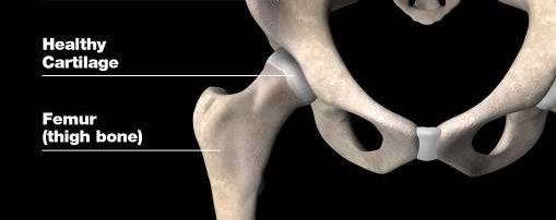 parts: A ball (femoral head) at the top of your thigh bone (femur) A
