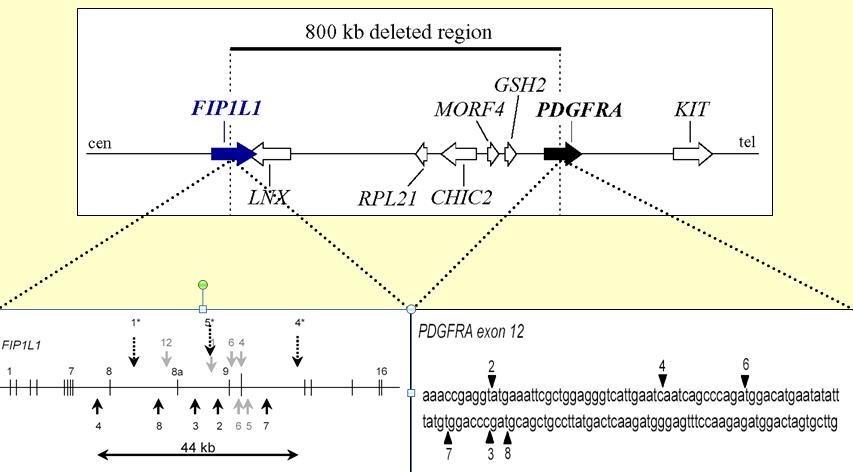 FIP1L1-PDGFRA mutation (F/P)
