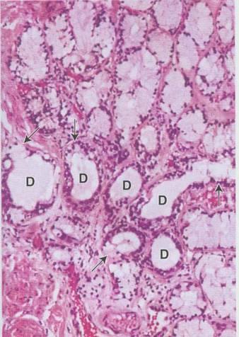 3. Bulbourethral glands Tubuloalveolar, mucus-secreting