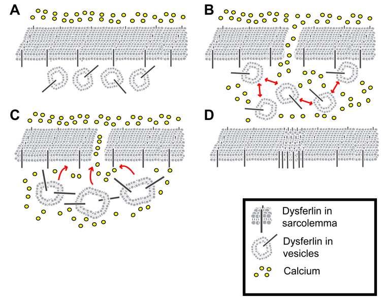 Figure 1-4. Hypothesized model for dysferlin-mediated membrane repair in skeletal muscle. A) Dysferlin-containing vesicles are present under the sarcolemma of resting skeletal muscle fibers.