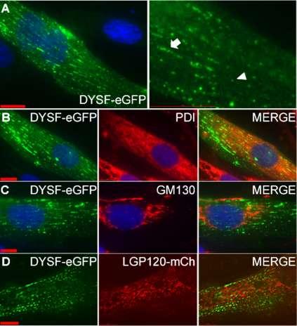 Figure 2-1. Dysferlin-eGFP localizes to a population of distinct vesicles in differentiated L6 myotubes.