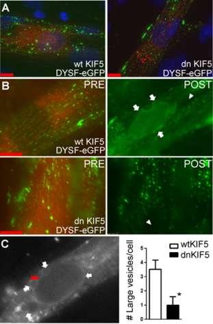 Figure 2-5. Expression of dnkif5 inhibits formation of large dysferlin-containing vesicles following membrane wounding in L6 myotubes.