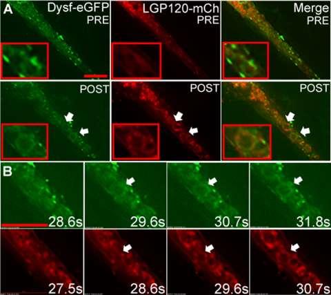 Figure 2-6. Dysferlin-eGFP interacts with lysosomal membranes following mechanical wounding in differentiated L6 cells.