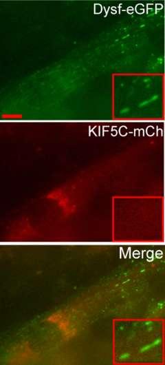 Figure 2-7. Dysferlin-containing vesicles do not label with KIF5C in differentiated L6 myotubes.