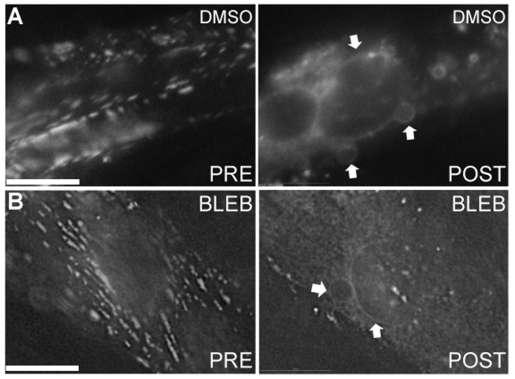 Figure 2-8. Pharmacological inhibition of actomyosin interaction does not affect formation of large dysferlin-containing vesicles following wounding in differentiated L6 myotubes.