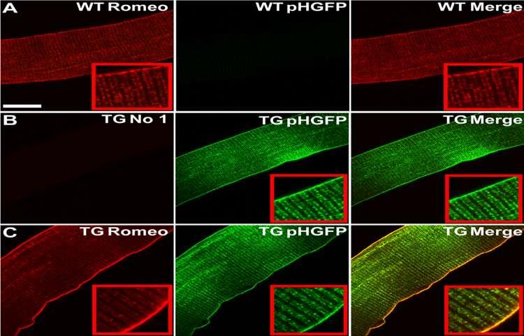 Figure 3-2. Dysf-pHGFP is localized at the lateral sarcolemma and striated internal membranes in adult skeletal muscle fibers from dysf-phgfp TG mice similar to endogenous dysferlin in wild-type mice.