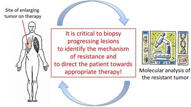 Re-Biopsia Realizar biopsias es esencial en el momento de la progresión para identificar el