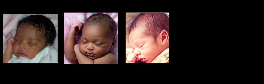 Were the babies switched? The Genetics of Blood Typesi Two couples had babies on the same day in the same hospital. Denise and Earnest had a girl, Tonja.