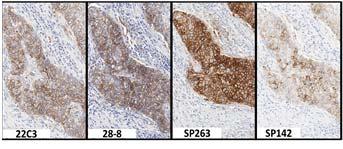 similar staining characteristics for PD L1 staining on
