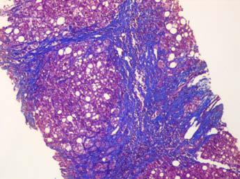 Patient Case: 39-Yr-Old Hispanic Male with Obesity,