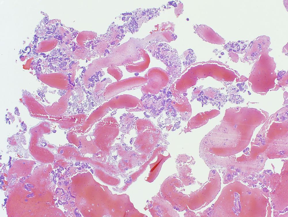 FNA cell