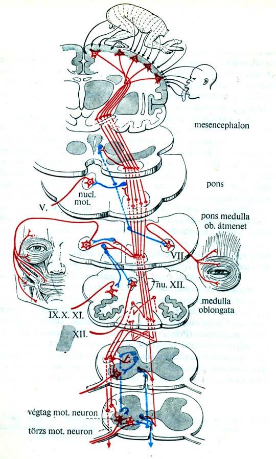 Peripheral facial paralysis (right side).