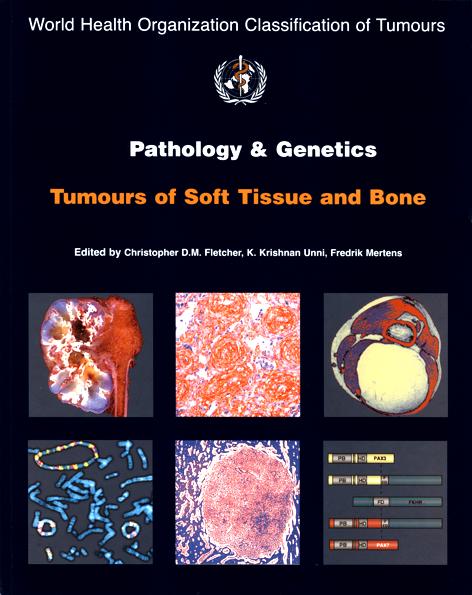 Characterization of soft tissue sarcomas / STS (~ 1% of all malignancies in adulthood, ~ 55 subtypes) - the pathologist s tasks - Tumor classification Tumor grading Tumor