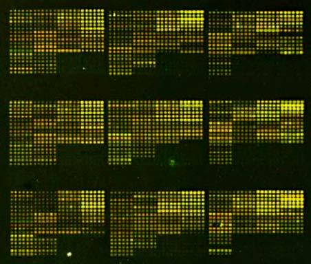 Chromosome 5p array-cgh Control-DNA Tumor-DNA Contig comprising 416 5p-BACs, 100 control-bacs (resolution approx.