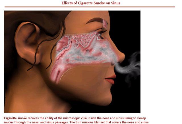 Cigarette Smoking Paralyzes the cilia & can cause many diseases. blood vessels.