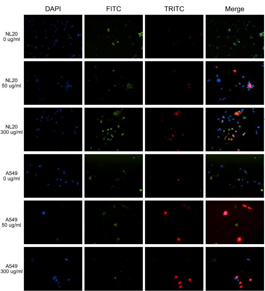 Figure 6. Effects of MOL extract addition to lung cell lines, NL20 and A549.